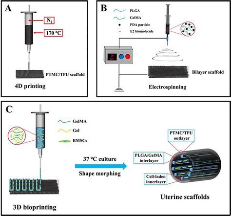 metal uterus fabrication|Biomimicking trilayer scaffolds with controlled estradiol release for .